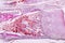 Study Histology of human, tissue bone under the microscopic.