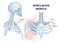 Subclavius muscle as upper body shoulder muscular system outline diagram