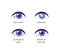 Summer uv sunscreen protection and eye diseave concept. Vector flat healthcare icon illustration set. Various eye disease symbol
