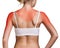 Sunburn female shoulder