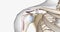 A superior labral tear is when a lesion is found in the upper portion for the labrum