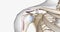 A superior labral tear is when a lesion is found in the upper portion for the labrum