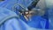 Surgeon hands performing laparoscopic surgery,