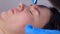 Surgeon removing mole using laser on woman face, burning skin, beauty treatment.