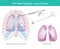 Surgical Technique For Lung Cancer.