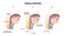 Swallowing process explanation with anatomical principle outline diagram