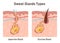 Sweat glands. Apocrine and eccrine gland anatomy. Cross section