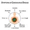 Symptoms Coronavirus disease. Flu coronavirus. Influenza. Infographics. Vector illustration on isolated background