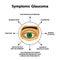 Symptoms of glaucoma. World glaucoma day. The anatomical structure of the eye. Infographics. Vector illustration on