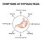 Symptoms of hypolactasia. Lactose intolerance.