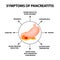 Symptoms of pancreatitis. The structure of the stomach and pancreas. Infographics. Vector illustration on isolated