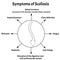 Symptoms of Scoliosis. Spinal curvature, kyphosis, lordosis of the neck, scoliosis, arthrosis. Improper posture and