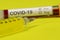 Syringe with needle drop and a blood tube with covid-19 label