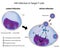 T cell infection by HIV