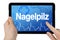 Tablet computer with the german word for nail fungus - Nagelpilz