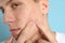 Teen guy with acne problem squeezing pimple on blue background, closeup