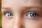 Teen\'s blue eyes staring up