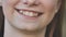 A teenage girl demonstrates her crooked teeth.