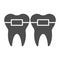 Teeth alignment solid icon. Mouth braces, orthodontic treatment symbol, glyph style pictogram on white background