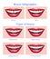 Teeth Braces Types Realistic Infographics