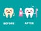 Teeth care concept. Before and after brushing teeth characters. Healthy smiling teeth with toothbrush and toothpaste. Crying yello