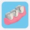 teeth with crack. Vector illustration decorative design