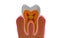 Teeth cross section