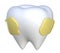 Teeth decay 3D icon illustration