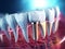 Teeth with dental implant. Generative AI