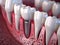 Teeth with dental implant. Generative AI