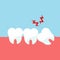 Teeth and gum problems. Impacted wisdom tooth for dentistry and dental surgery in flat style vector illustration