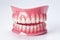 Teeth model with orthodontic denture on white background.Generative AI