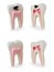 Teeth models