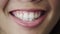 Teeth, mouth and smile with a black woman in studio on a dark background for carefree positivity closeup. Dentist