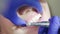 Teeth polishing procedure. Dentist hands working with dental high speed drill