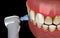 Teeth polishing procedure with professional brush and gel. Medically accurate 3D illustration