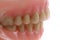 teeth prothesis background