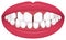 Teeth trouble  bite type / crooked teeth  vector illustration /Excessive Spacing