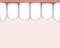 Teeth on the upper jaw after visiting the orthodontic clinic as a concept of healthy molars and incisors, vector stock