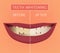 Teeth vector Whitening