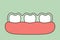 Teeth wear silicone trainer or invisible braces, dental health concept