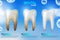 Teeth whitening 3d concept. Comparison of clean and dirty tooth before and after whitening
