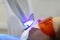 Teeth whitening in a dental clinic. A young woman whitens her teeth with the help of special equipment. Dental procedure