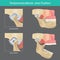 Temporomandibular joint position.