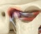 Temporomandibular joints arthritis and dislocated articular disc. Medically accurate 3D illustration