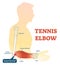 Tennis elbow medical fitness anatomy vector illustration diagram with arm bones, joint and muscles.