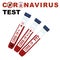 Test Coronavirus Pandemic concept, Patient`s blood tubes. Test Covid-19, 2019-nCoV Novel Coronavirus, Blood Virus
