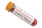 Test tube with blood sample positive SARS coronavirus, 3D render