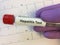 Test tube for Hepatitis virus blood testing