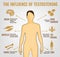 Testosterone Effects Infographics